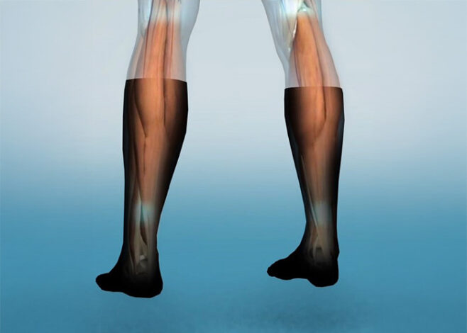 MEDICAL SOCKS