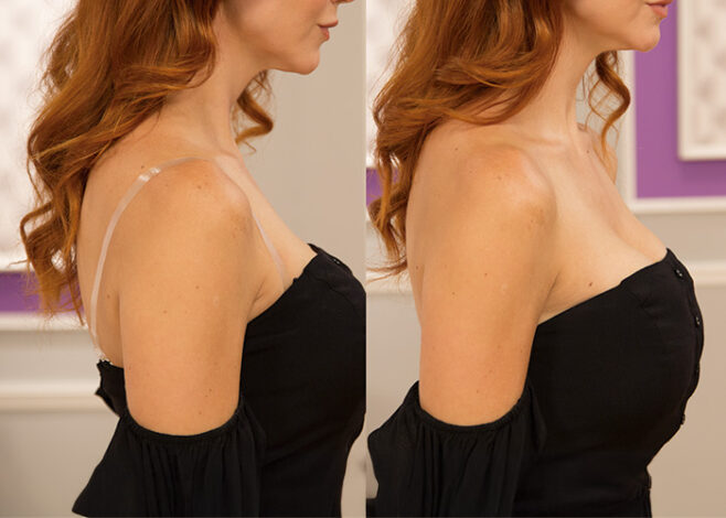 Velform Perfect Cleavage